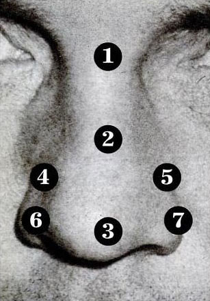 Акупунктура носа